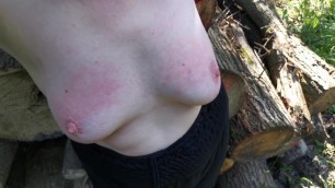 Slapping tits red for fun in woods DC