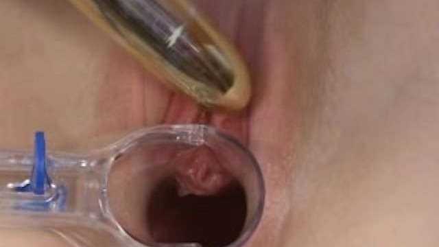 18 Y/o's Vagina Masturbation With Speculum